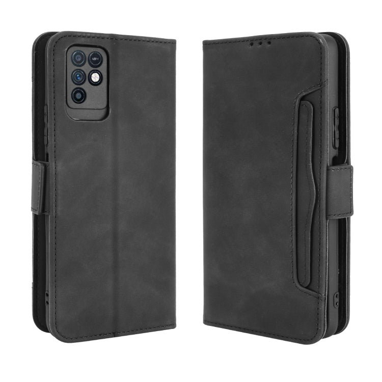 For Infinix Note 10 Skin Feel Calf Pattern Horizontal Flip Leather Case with Holder & Card Slots & Photo Frame(Black) - Infinix Cases by buy2fix | Online Shopping UK | buy2fix