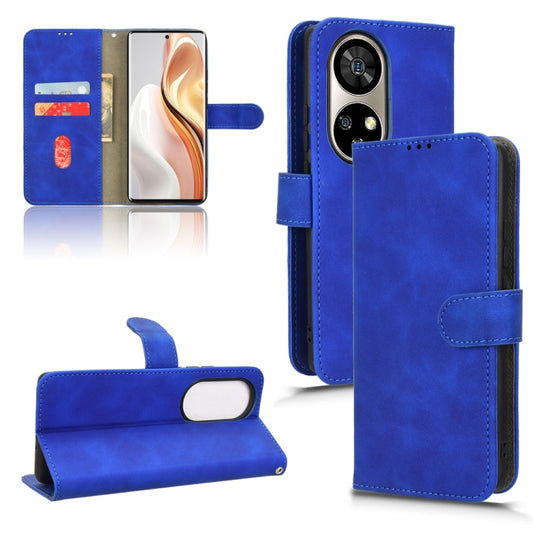 For Ulefone Note 17 Pro Skin Feel Magnetic Flip Leather Phone Case(Blue) - Ulefone Cases by buy2fix | Online Shopping UK | buy2fix